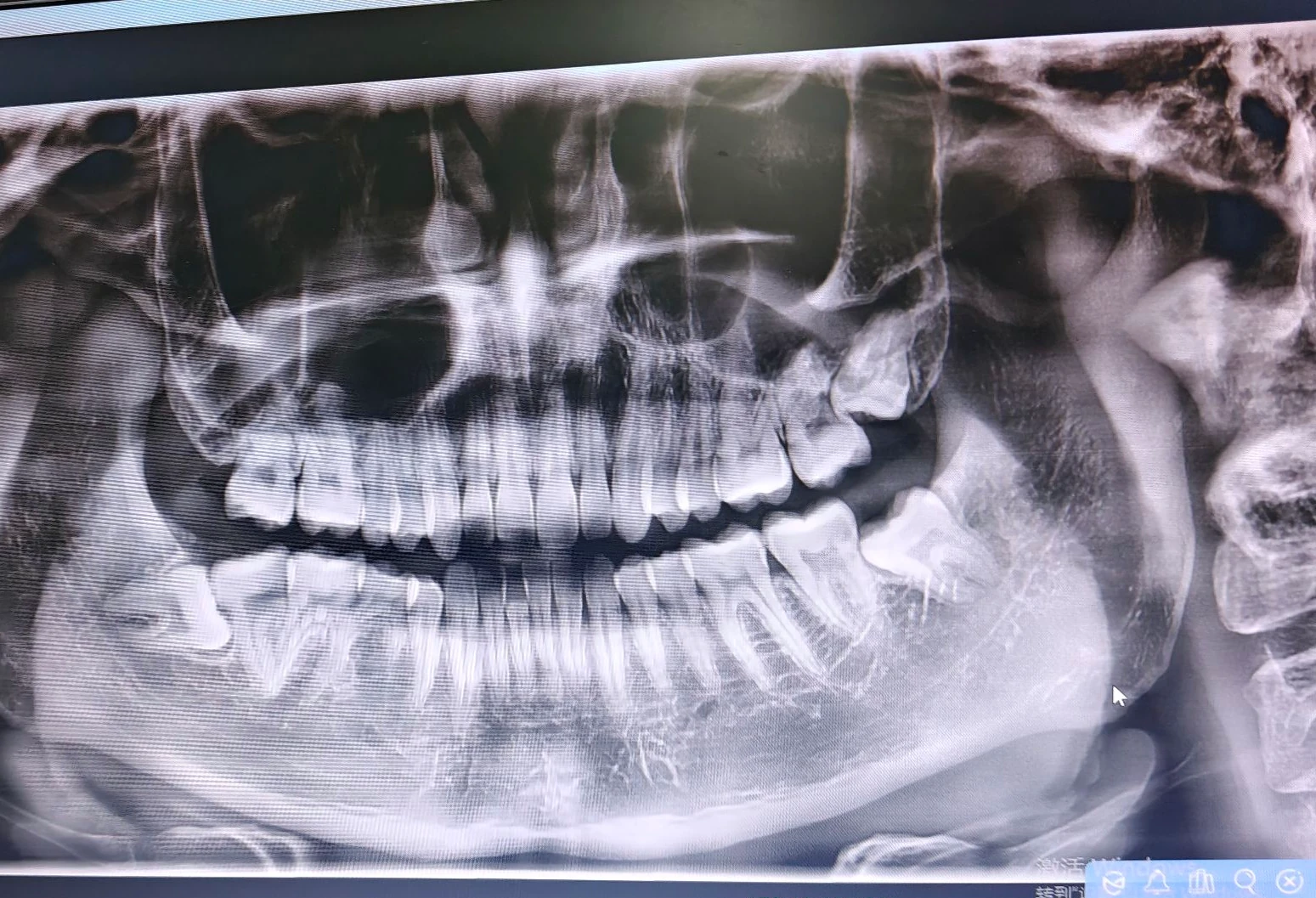 CBCT.webp CBCT.webp